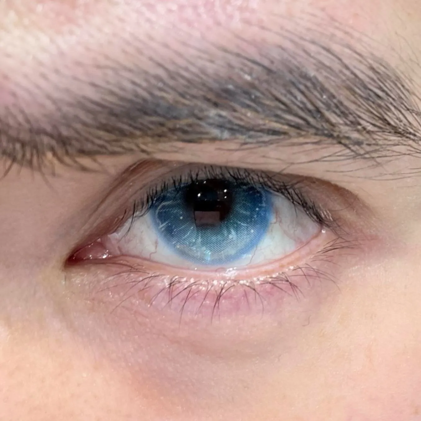 EyeLensy Jellyfish Glow Blue | 6 Months